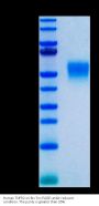 Human TNFR2/CD120b/TNFRSF1B Protein (TNF-HM1R2)