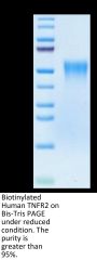 Biotinylated Human TNFR2/CD120b/TNFRSF1B Protein (Primary Amine Labeling) (TNF-HM1R2B)