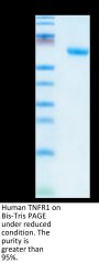 Human TNFR1/CD120a/TNFRSF1A Protein (TNF-HM2R1)