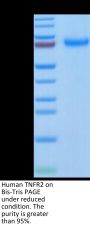 Human TNFR2/CD120b/TNFRSF1B Protein (TNF-HM2R2)