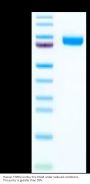 Human TNFR2/CD120b/TNFRSF1B Protein (TNF-HM3R2)