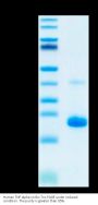 Human TNF alpha Protein (TNF-HM40A)