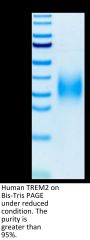 Human TREM2 Protein (TRM-HM102)