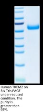 Human TREM2 Protein (TRM-HM201)