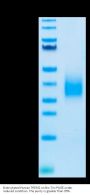 Biotinylated Human TREM2 Protein (TRM-HM401B)