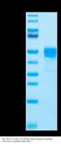 Rat TROP-2/TACSTD2 Protein (TRP-RM121)