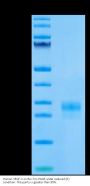 Human VEGF-C/Flt4-L Protein (VEG-HM4F1)