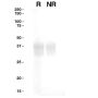 Recombinant Human ApoE3 - 500 µg
