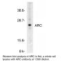Anti-Human Apoptosis Repressor with CARD Domain (NT) (ARC) - 0.1 mg
