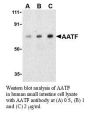 Anti-Human Apoptosis Antagonizing Transcription Factor (AATF) - 0.1 mg