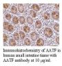 Anti-Human Apoptosis Antagonizing Transcription Factor (AATF) - 0.1 mg