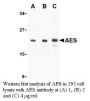 Anti-Human Amino-terminal Enhancer of Split (CT) (AES) - 0.1 mg