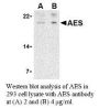 Anti-Human Amino-terminal Enhancer of Split (NT) (AES) - 0.1 mg