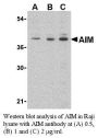 Anti-Human AIM (CT) - 0.1 mg
