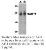 Anti-Human Akt1 - 0.1 mg