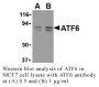 Anti-Human Activating Transcription Factor 6 (CT) (ATF6) - 0.1 mg