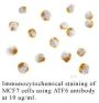 Anti-Human Activating Transcription Factor 6 (CT) (ATF6) - 0.1 mg