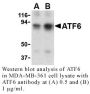Anti-Human Activating Transcription Factor 6 (NT) (ATF6) - 0.1 mg