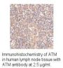 Anti-Human ATM - 0.1 mg