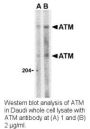 Anti-Human ATM - 0.1 mg