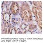 Anti-Human Bnip3L (Intermediate Domain) - 20 µg