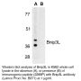 Anti-Human Bnip3L (Intermediate Domain) - 20 µg