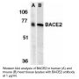 Anti-Human Beta-Site APP Cleaving Enzyme 2 (NT) (BACE2) - 0.1 mg