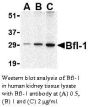 Anti-Human Bfl-1 (CT) - 20 µg