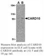 Anti-Human CARD10 (CT) - 20 µg