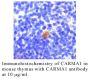 Anti-Human CARMA1 - 20 µg