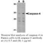 Anti-Human Casp-4 (NT) - 20 µg