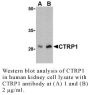 Anti-Human CTRP1 (NT) - 20 µg