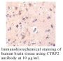Anti-Human CTRP2 (Intermediate Domain) - 0.1 mg