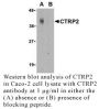 Anti-Human CTRP2 (NT) - 20 µg