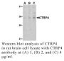 Anti-Human CTRP4 (CT) - 20 µg