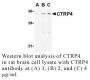 Anti-Human CTRP4 (NT) - 0.1 mg