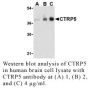 Anti-Human CTRP5 (NT) - 20 µg