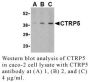 Anti-Human CTRP5 (Intermediate Domain) - 20 µg