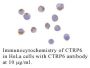 Anti-Human CTRP6 (CT) - 20 µg