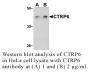 Anti-Human CTRP6 (CT) - 20 µg