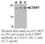 Anti-Human CTRP7 (CT) - 0.1 mg