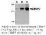Anti-Human CTRP7 - 20 µg