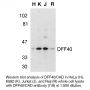 Anti-Human DFF40 (I18) - 0.1 mg