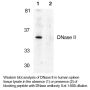 Anti-Human DNase II (CT) - 20 µg