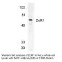 Anti-Human TRAIL R3 (Extracellular Domain-1) - 20 µg