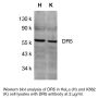 Anti-Human DR5 (CT) - 20 µg