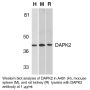 Anti-Human DAPK2 - 0.1 mg