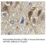 Anti-Human G Beta Protein Subunit-like (GβL) - 0.1 mg