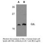 Anti-Human G Beta Protein Subunit-like (GβL) - 0.1 mg