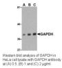 Anti-Human GAPDH (CT) - 0.1 mg